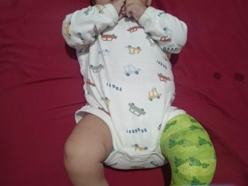 {{brizy_dc_image_alt entityId=