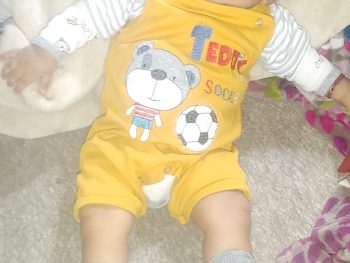 {{brizy_dc_image_alt entityId=