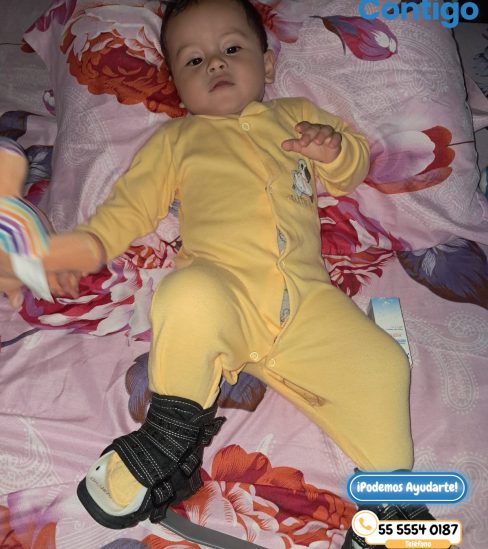 {{brizy_dc_image_alt entityId=